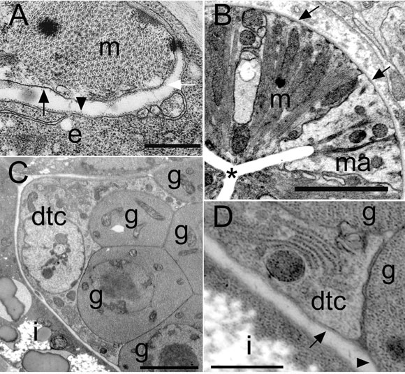 C. elegans basement membrane morphologies Figure 1