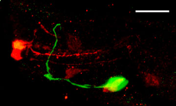 Hard Fixation in Tubes to Visualize Neurotransmitters Figure 2