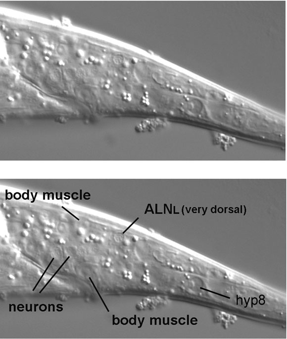 The cell body of the neuron ALNL figure 10