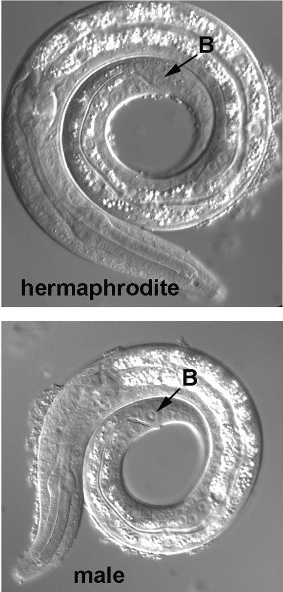 The rectal cell B, prior to its division in an L1 male, with the corresponding image from an L1 hermaphrodite figure 12