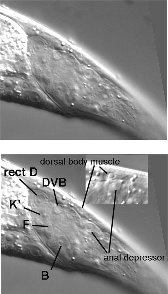 The nucleus of rect D and the distinction of the left dorsal body muscle from the anal depressor muscle figure 13