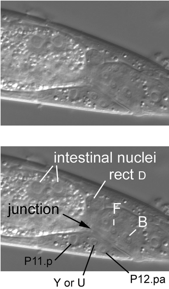 Centrally located nuclei immediately anterior of the rectum figure 18
