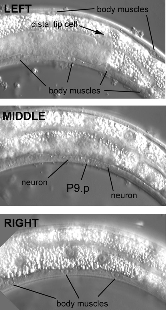 Careful adjustment of the focus helps to distinguish Pn.p nuclei from left and right body muscles figure 20