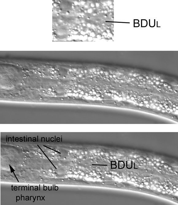 The isolated cell body of the neuron BDUL figure 35